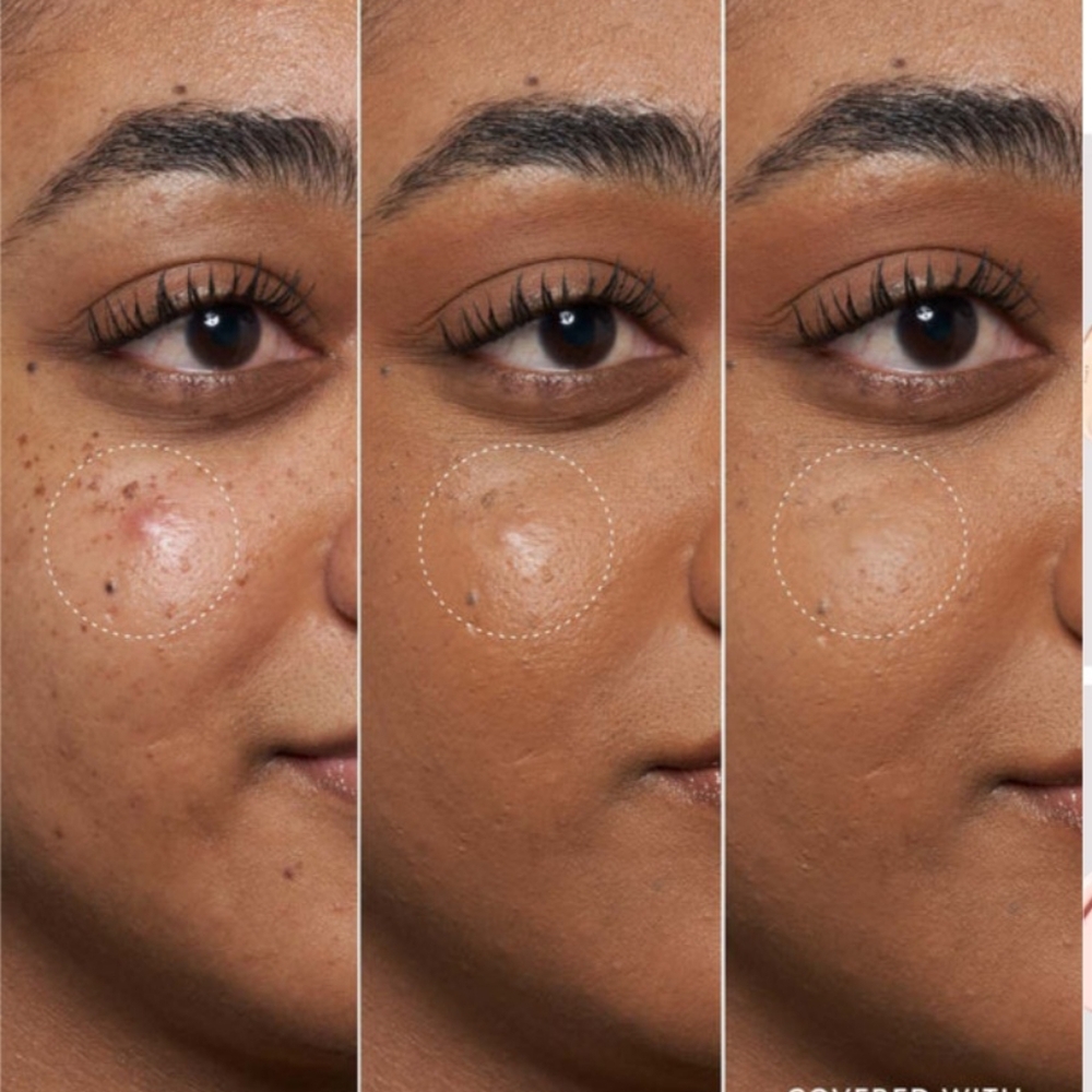 Fenty Skin Blemish Defeat'r BHS Spot Targeting Gel - Picture 5 of 5